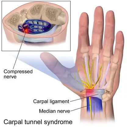 NervEase Nerve Support Supplement